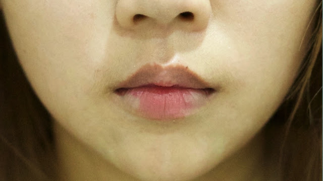 改變嘴唇比例的秘密｜關於新式材質Volift玻尿酸的運用