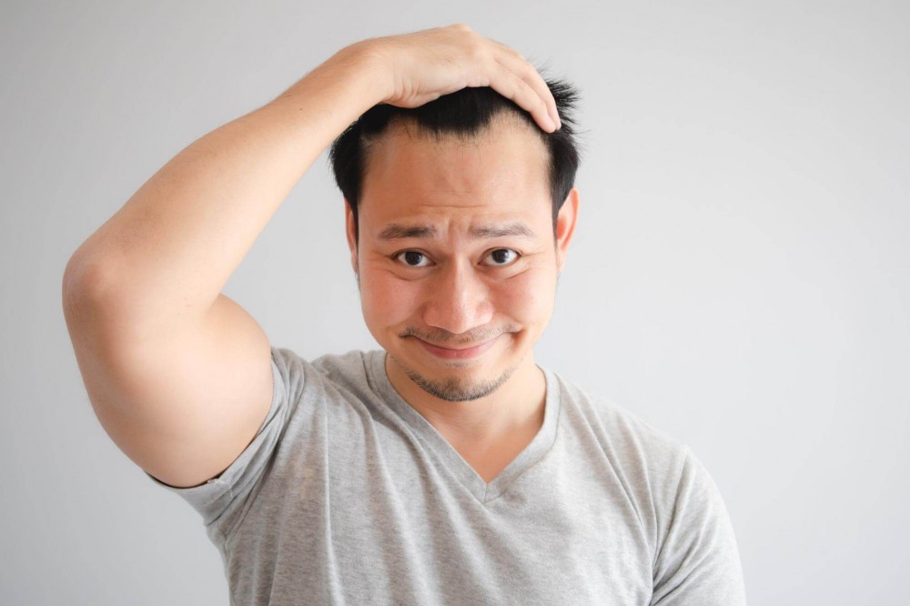 髮量少原因是什麼？找出您髮量減少的關鍵