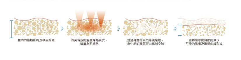 海芙音波拉提-身體