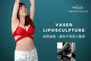 vaser威塑抽脂心得分享｜vaser威塑脂雕讓我再現性感腰身！