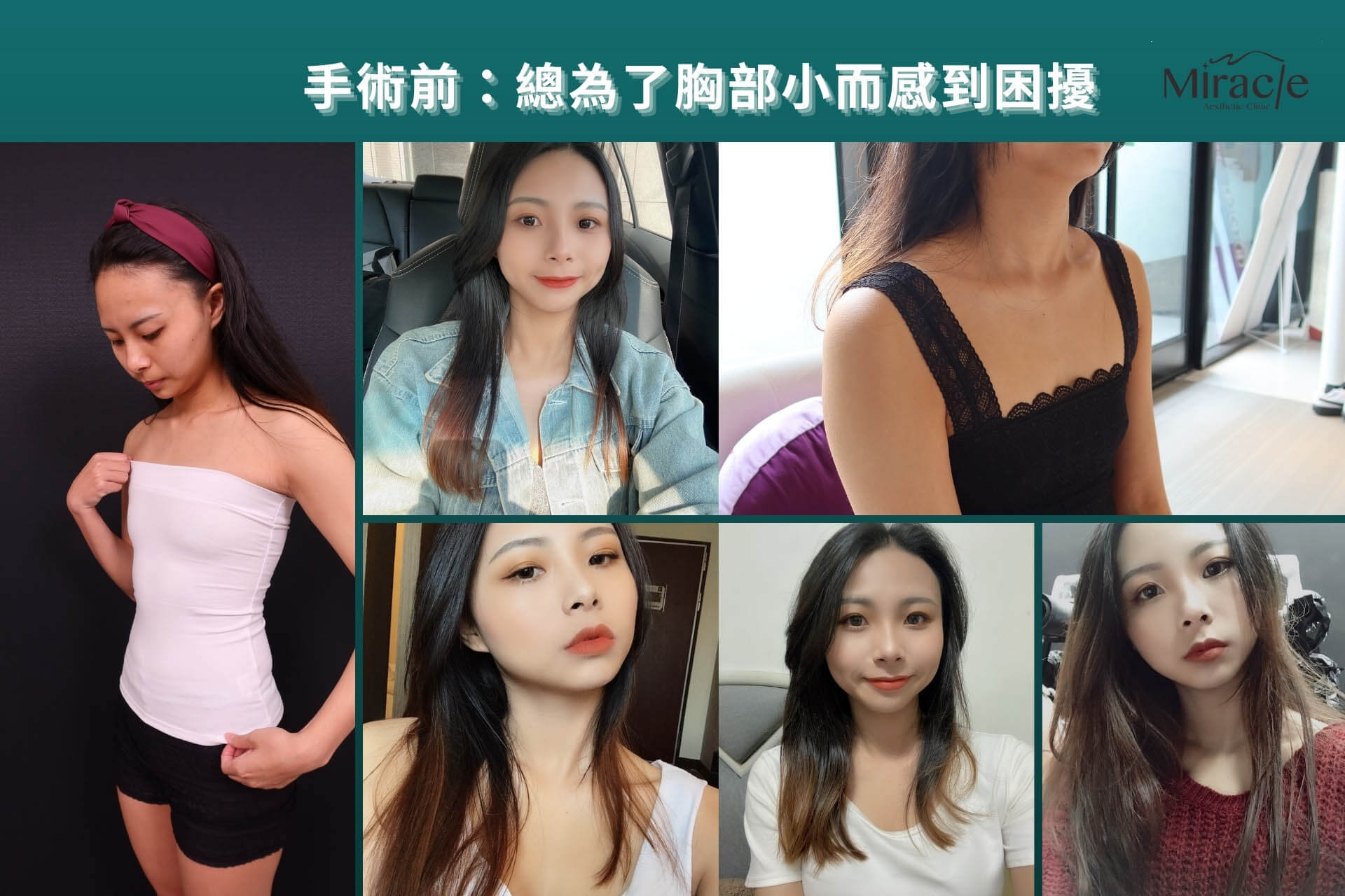 還沒有做隆乳手術前，對你來說最大的困擾是什麼？