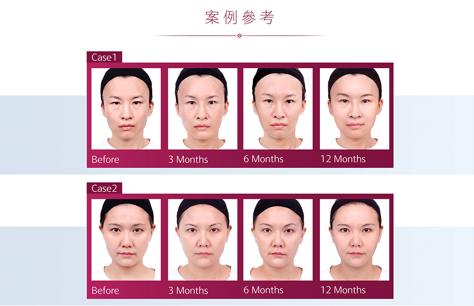 舒顏萃適用對象