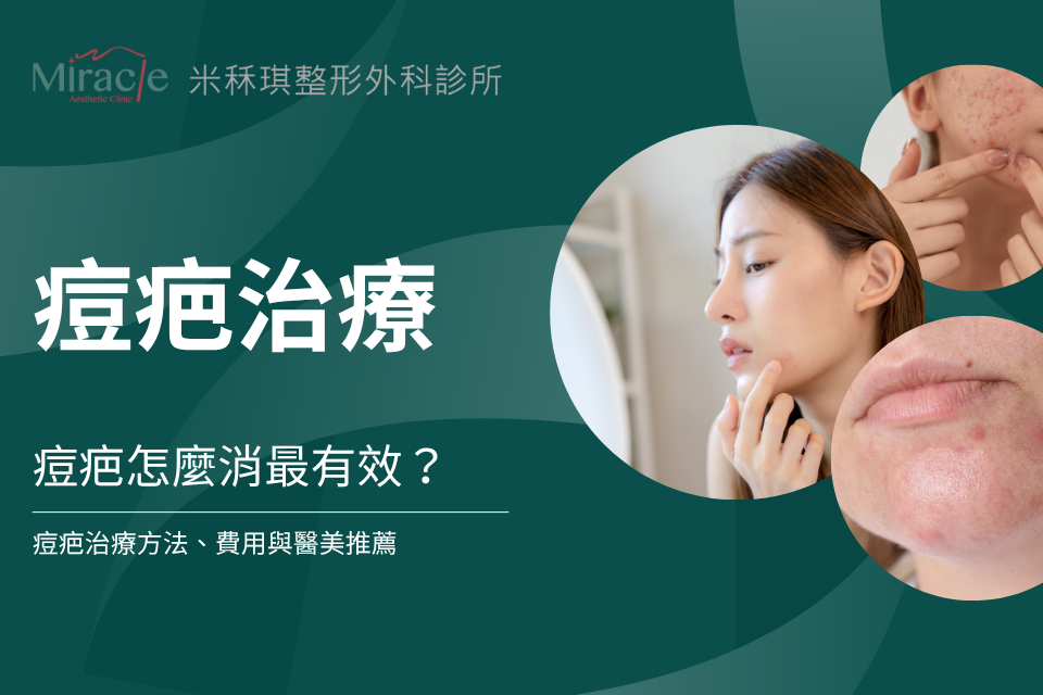 痘疤怎麼消最有效？痘疤治療方法、費用與醫美推薦