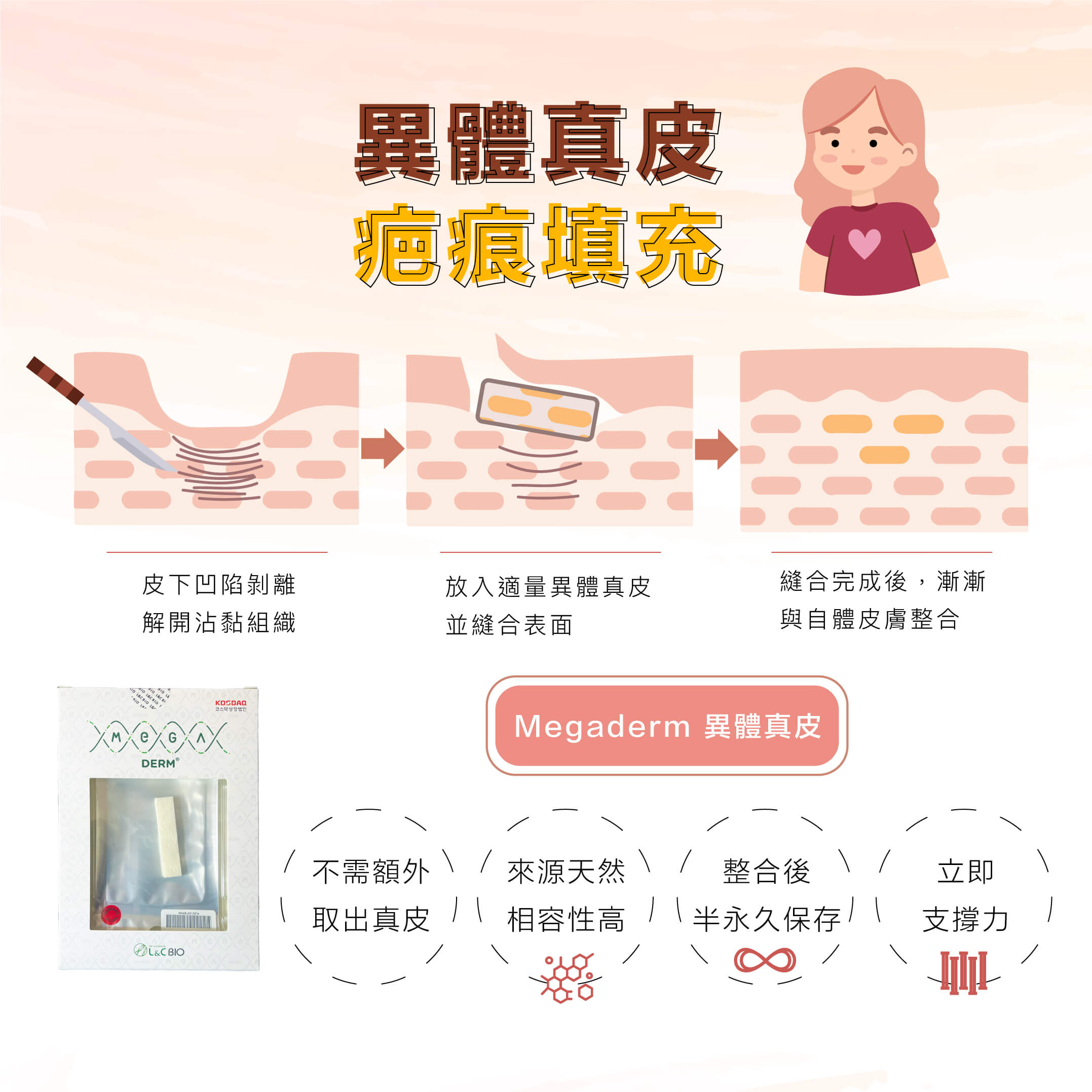 異體真皮疤痕填充
