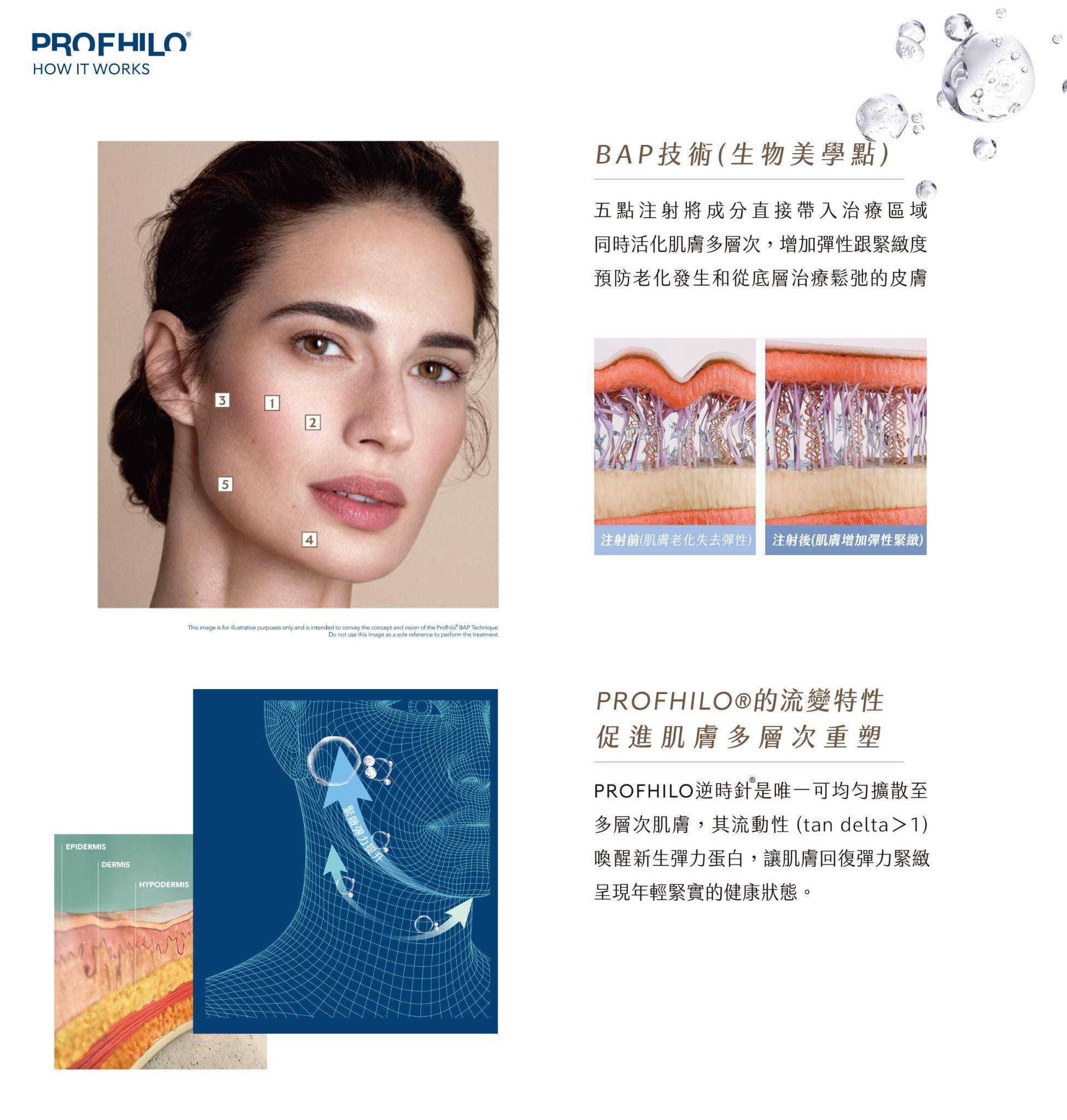 Profhilo逆時針特色