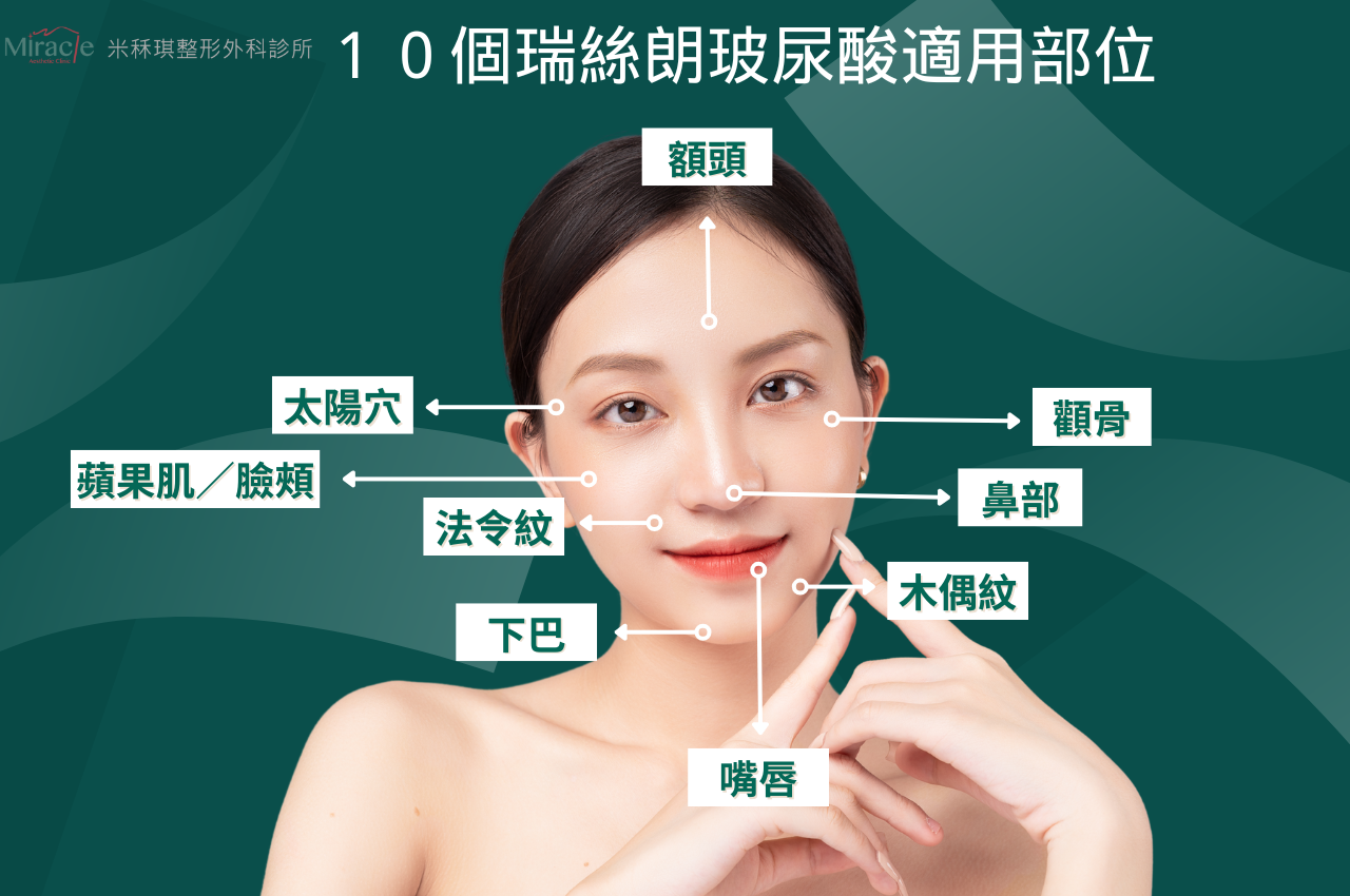 Restylane瑞絲朗玻尿酸適用部位：額頭、太陽穴（夫妻宮）、顴骨、蘋果肌、臉頰、鼻部、法令紋、木偶紋
嘴唇、下巴