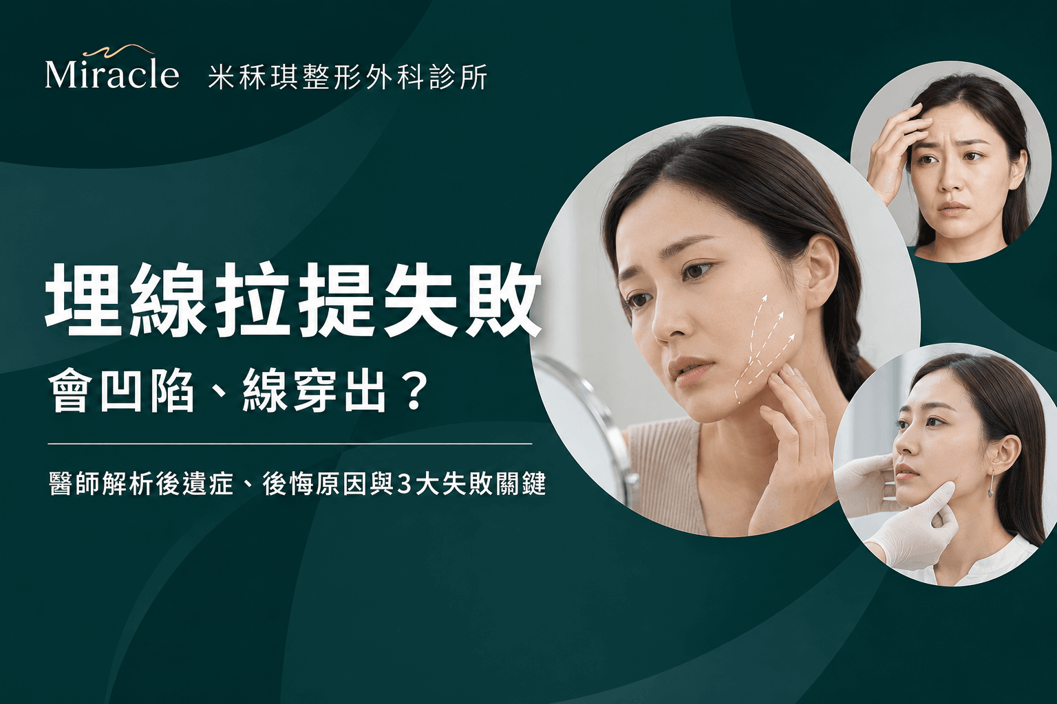 埋線拉提失敗會凹陷、線穿出？後遺症與3大原因解析