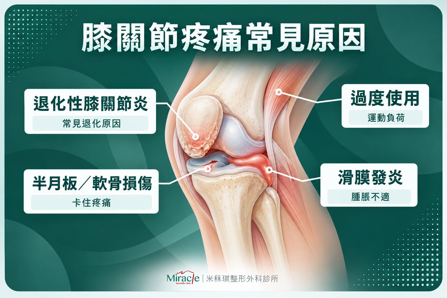 膝關節疼痛原因有哪些？
